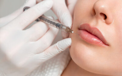 Dermal Fillers